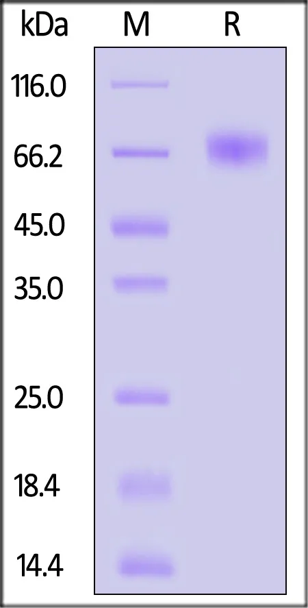 Cynomolgus Coagulation factor IX / F9 Protein, His Tag (active enzyme, MALS verified) - image 1