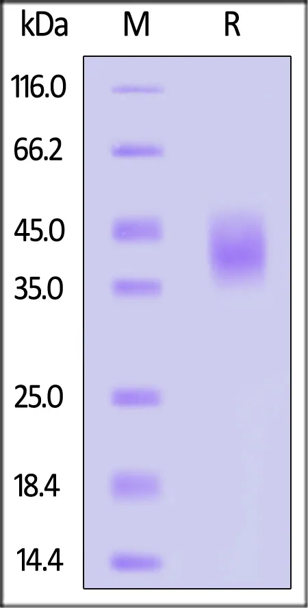 Canine Fc gamma RI / CD64 Protein, His Tag (MALS & SPR verified) - image 1