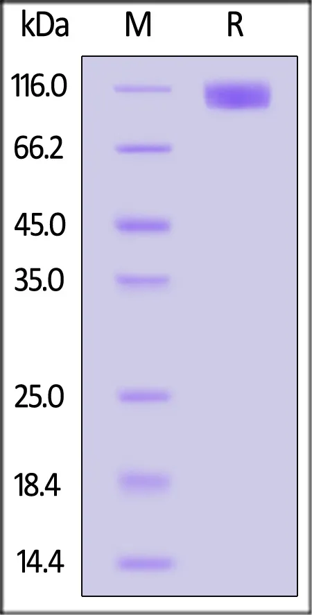 Cynomolgus OSMR beta Protein, His Tag (MALS verified) - image 1