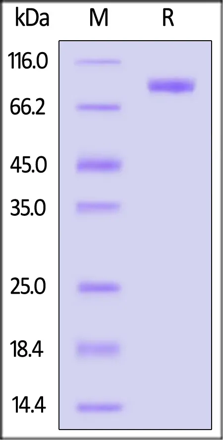 Human SLITRK6 Protein, His Tag (MALS verified) - image 1