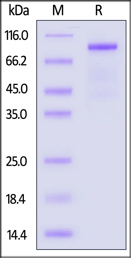 Biotinylated Mouse IL-12 R beta 1 / CD212 Protein, His,Avitag™ - image 1