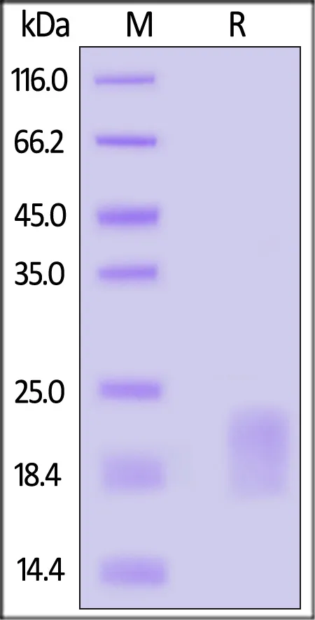Mouse GM-CSF Protein, Tag Free - image 1