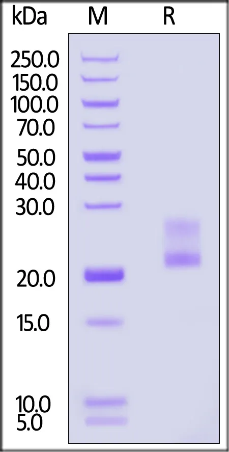 Mouse IFN-gamma / IFNG Protein, His Tag (MALS verified) - image 1