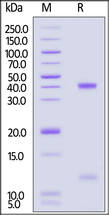 Biotinylated Human HLA-A*02:01&B2M&HBV (FLLTKILTI) Complex Protein (Monomer, MALS verified) - image 1