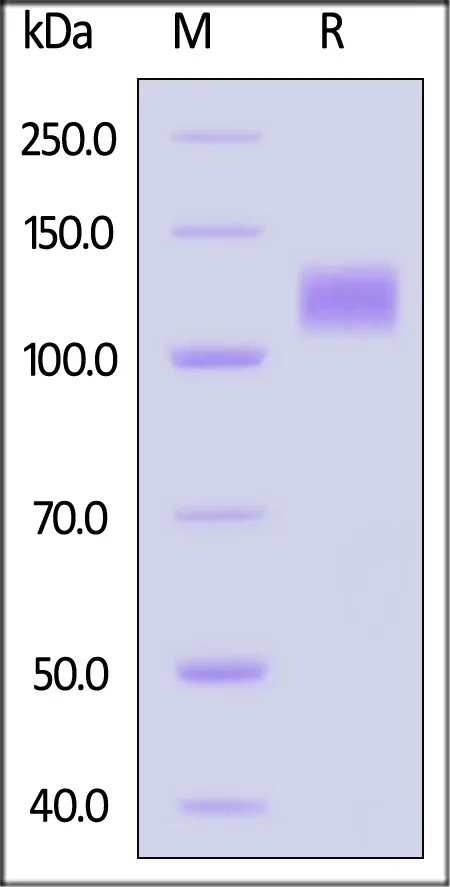 Cynomolgus IL-31 RA Protein, Fc Tag - image 1