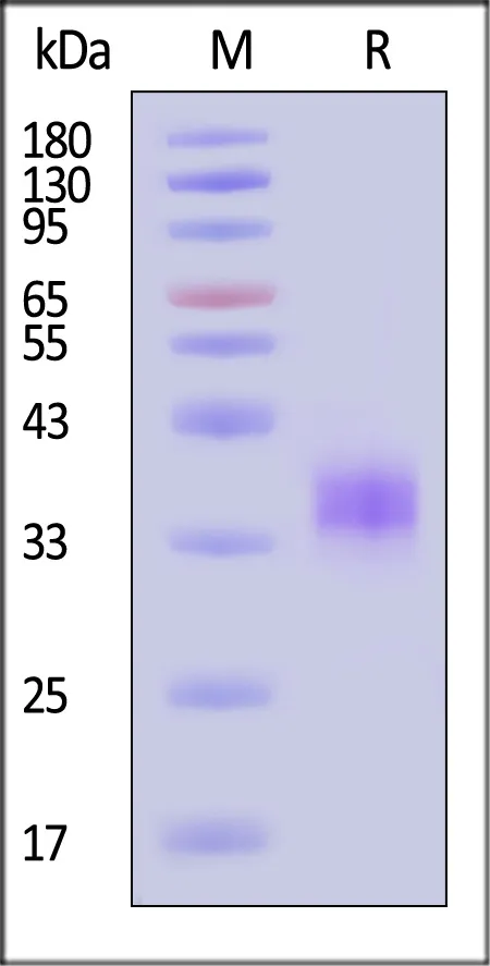 SARS-CoV-2 Spike RBD Protein, His Tag (XBB.1.5/Omicron) (MALS verified) - image 1
