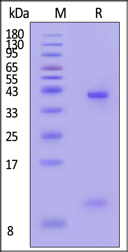 Biotinylated Human HLA-A*03:01&B2M&KRAS (VVGAGGVGK) Complex Protein (Monomer, MALS verified) - image 1