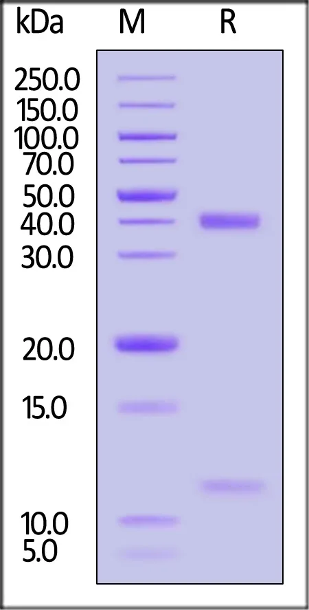 Human HLA-A*11:01&B2M&KRASG12D (VVGADGVGK) Complex Protein (Monomer, MALS verified) - image 1
