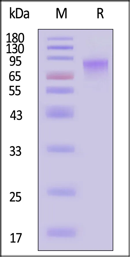 Biotinylated Cynomolgus GUCY2C / Guanylyl cyclase C Protein, His,Avitag™ (MALS verified) - image 1