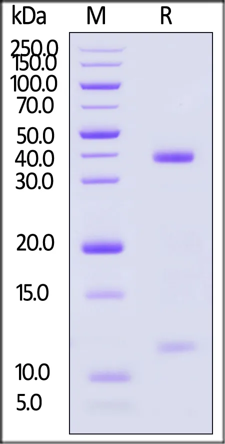 Biotinylated Human HLA-A*11:01&B2M&EBV (AVFDRKSDAK) Complex Protein (Monomer, MALS verified) - image 1