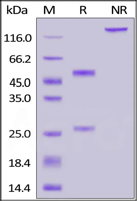 Anti-SARS-CoV-2 Spike S1 Antibody, Mouse IgG1 (AS59) - image 1