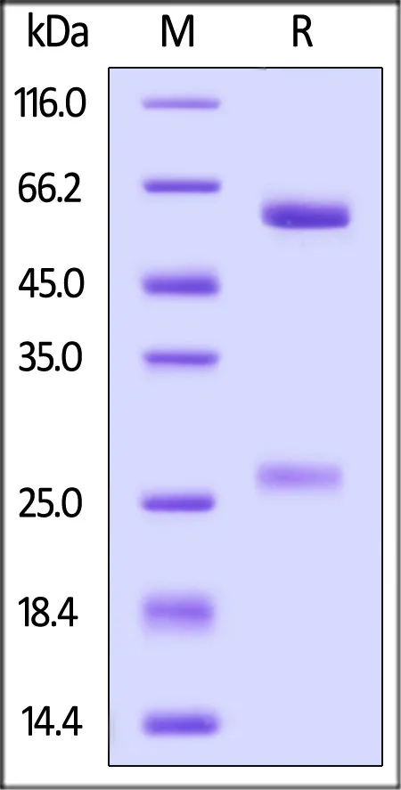 Anti-SARS-CoV-2 Spike RBD Broadly Neutralizing Antibody, Human IgG3 (AM359b) (MALS verified) - image 1