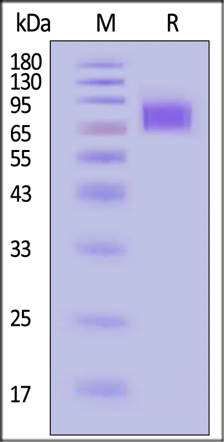 Cynomolgus IFN-alpha/beta R1 Protein, His Tag (MALS verified) - image 1