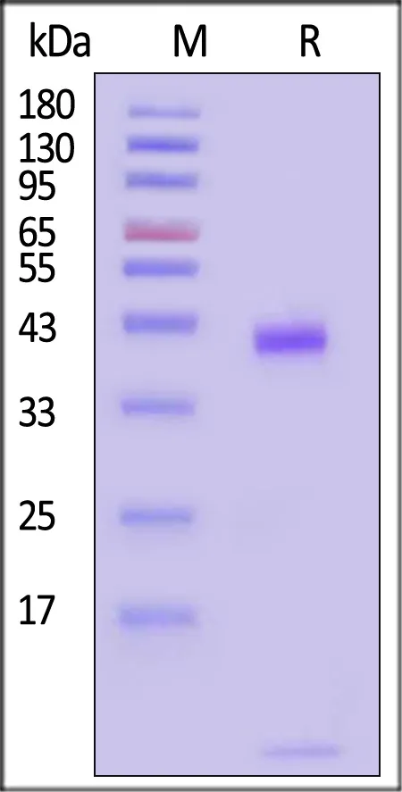 Biotinylated Human HLA-A*11:01&B2M&EBV LMP2 (SSCSSCPLSK) Complex Protein (Monomer, MALS verified) - image 1