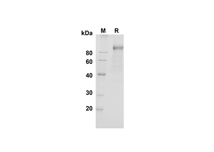 Recombinant Mouse DPPIV/CD26 Protein(His Tag) - image 1