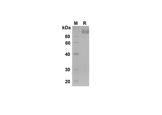 Recombinant Mouse P-Selectin/CD62P Protein(His Tag) - image 1