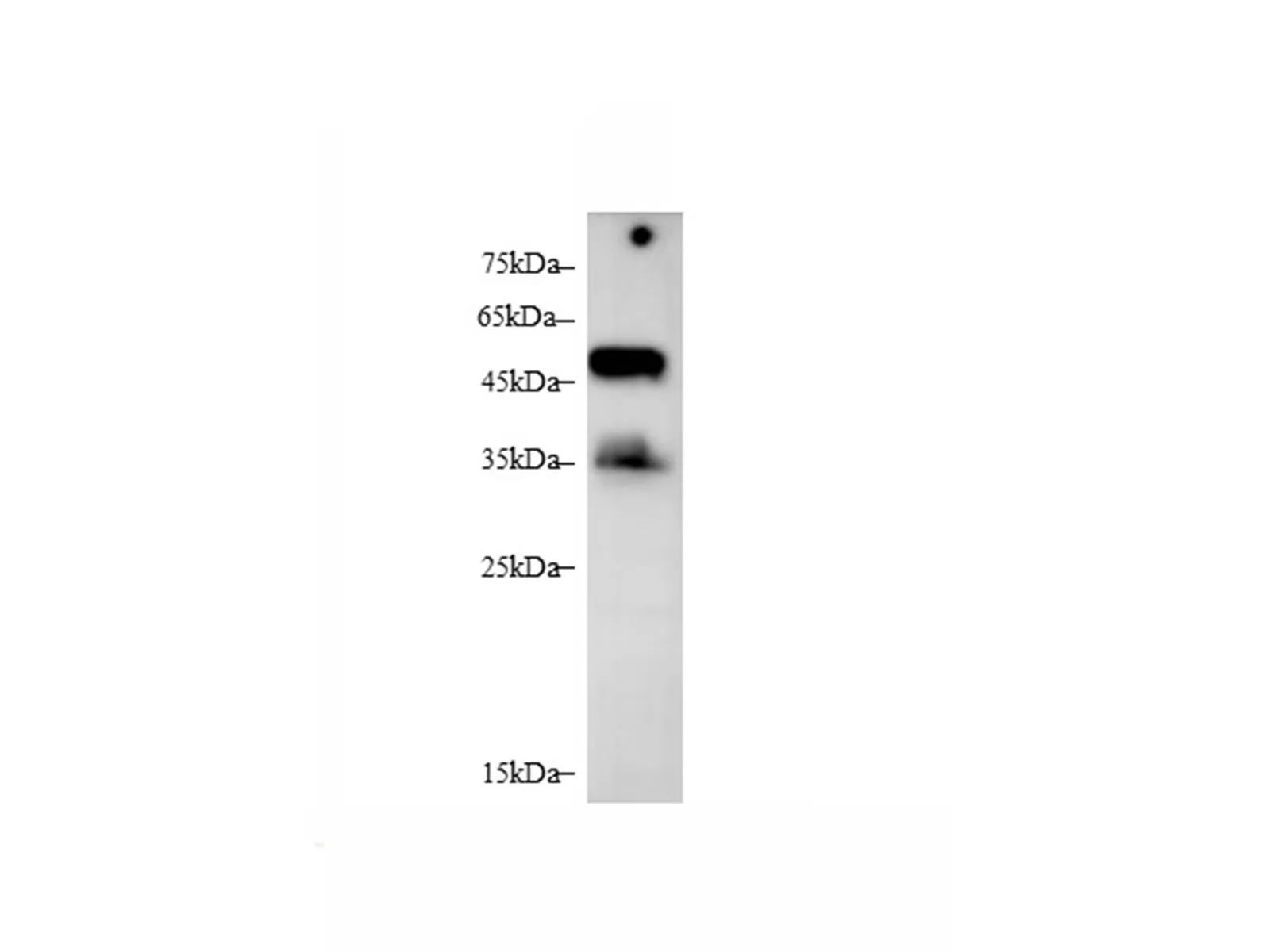 BAFFR/TNFRSF13C Polyclonal Antibody - image 1