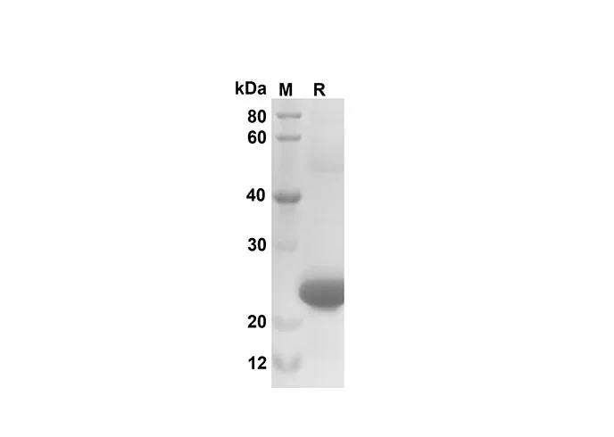Recombinant Mouse CXCL3/CINC-2α/β Protein(Sumo Tag) - image 1