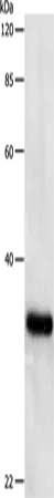 PCNA Polyclonal Antibody - image 1