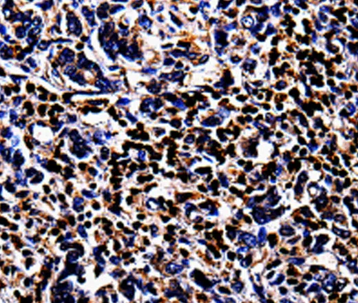 S100A4 Polyclonal Antibody - image 1