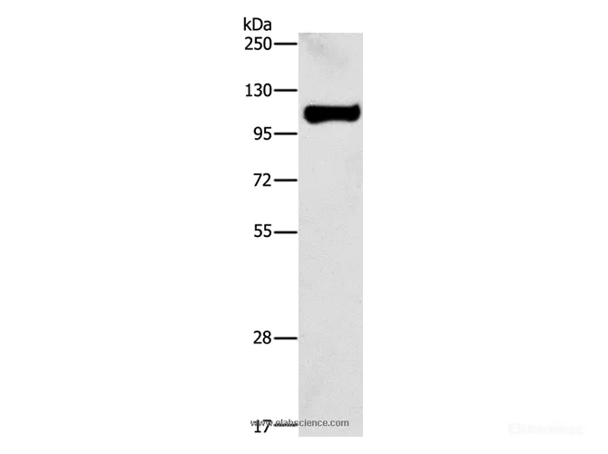 STAT6 Polyclonal Antibody - image 1