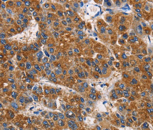 APLNR Polyclonal Antibody - image 1