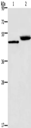 Cathepsin E Polyclonal Antibody - image 1