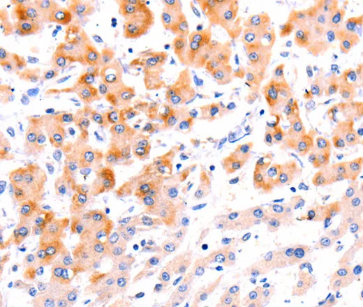 Ephrin A1 Polyclonal Antibody - image 1