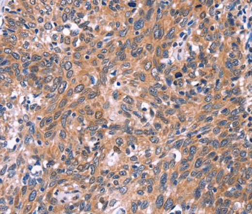EDN1 Polyclonal Antibody - image 1