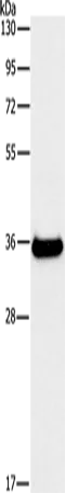 FGL1 Polyclonal Antibody - image 1