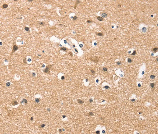 HDAC8 Polyclonal Antibody - image 1