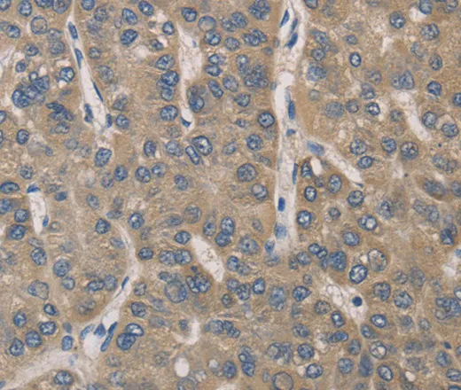 IRAK4 Polyclonal Antibody - image 1