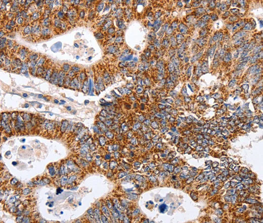 MAP2K5 Polyclonal Antibody - image 1