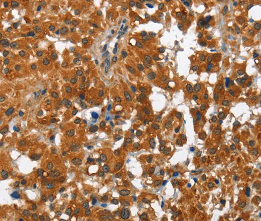PAK2 Polyclonal Antibody - image 1