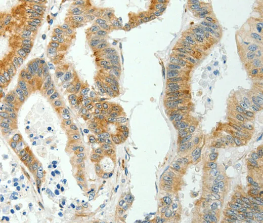 SELENOM Polyclonal Antibody - image 1