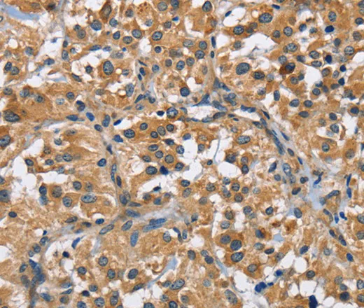 FLT3 Polyclonal Antibody - image 1