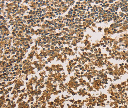 SETD2 Polyclonal Antibody - image 1
