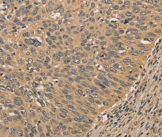 PRDM14 Polyclonal Antibody - image 1