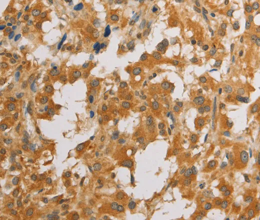 ATG4D Polyclonal Antibody - image 1