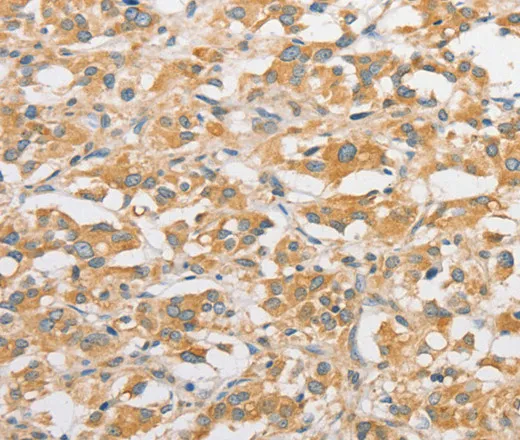 TLR5 Polyclonal Antibody - image 1