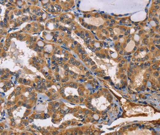 EPHB6 Polyclonal Antibody - image 1