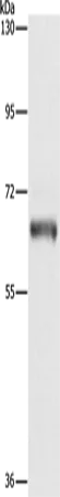 KLC1 Polyclonal Antibody - image 1