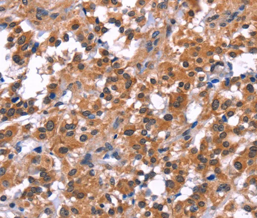 PIP5K1B Polyclonal Antibody - image 1