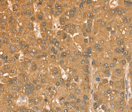 CXCR4 Polyclonal Antibody - image 1