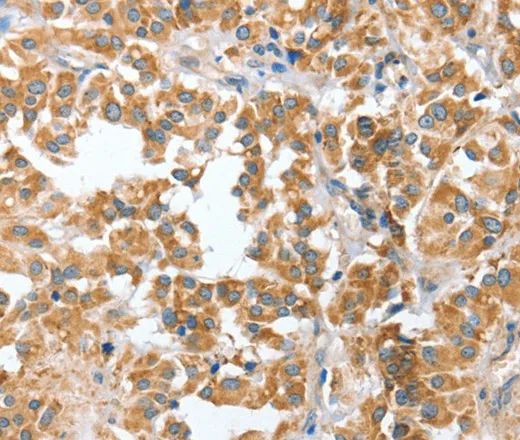 CIAPIN1 Polyclonal Antibody - image 1