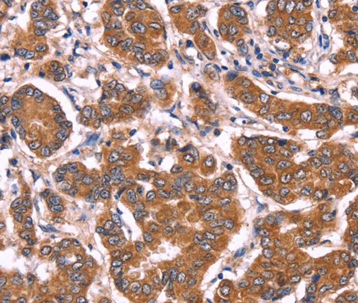 COL20A1 Polyclonal Antibody - image 1