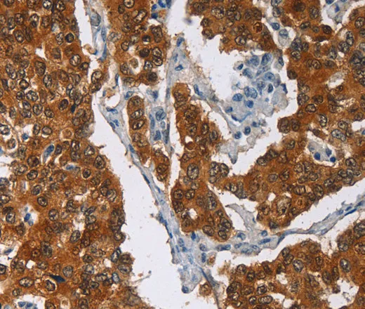 CRABP2 Polyclonal Antibody - image 1