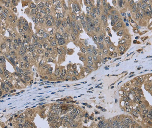 DCTN4 Polyclonal Antibody - image 1