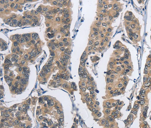 DSG2 Polyclonal Antibody - image 1