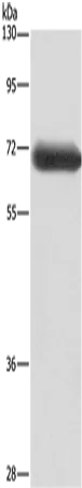 DPYSL3 Polyclonal Antibody - image 1